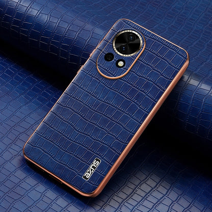 Huawei nova 13 Luxury Case - Electroplated Frame, Crocodile Texture Leather, Full Coverage Protection, Anti-Fingerprint & Shockproof
