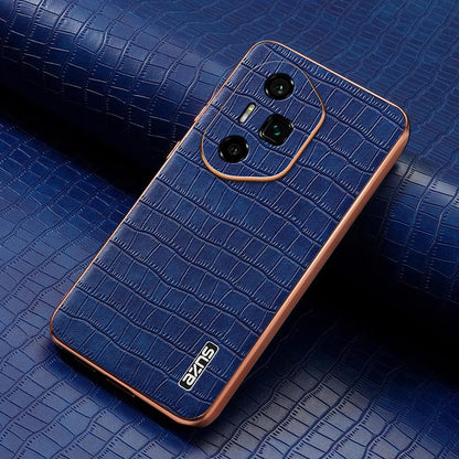 Honor 300 Ultra Luxury Case - Electroplated Frame, Crocodile Texture Leather, Full Coverage Protection, Anti-Fingerprint & Shockproof