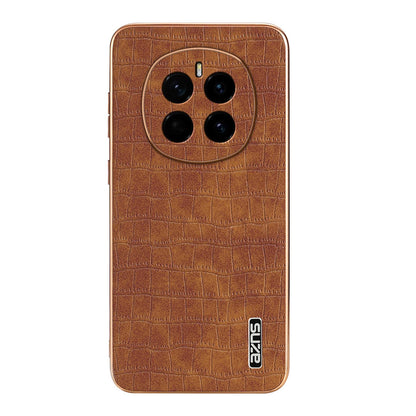 Honor Magic7 Luxury Case - Electroplated Frame, Crocodile Texture Leather, Full Coverage Protection, Anti-Fingerprint & Shockproof