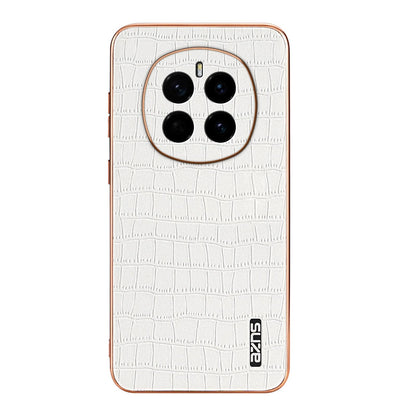 Honor Magic7 Luxury Case - Electroplated Frame, Crocodile Texture Leather, Full Coverage Protection, Anti-Fingerprint & Shockproof