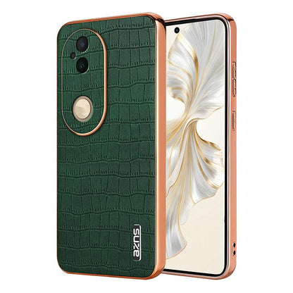 vivo S20 Luxury Case - Electroplated Frame, Crocodile Texture Leather, Full Coverage Protection, Anti-Fingerprint & Shockproof