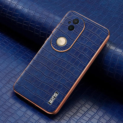 vivo S20 Luxury Case - Electroplated Frame, Crocodile Texture Leather, Full Coverage Protection, Anti-Fingerprint & Shockproof